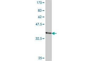 Western Blot detection against Immunogen (35. (CACNB2 抗体  (AA 213-301))