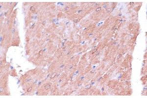Immunohistochemistry of paraffin-embedded Mouse heart using TIMM8B Polyclonal Antibody at dilution of 1:100 (40x lens).