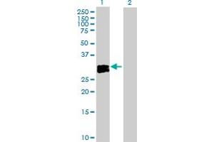 Western Blot analysis of OSM expression in transfected 293T cell line by OSM MaxPab polyclonal antibody.
