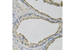Immunohistochemistry of paraffin-embedded human prostate using LCN1 antibody  at dilution of 1:100 (40x lens). (Lipocalin 1 抗体  (AA 19-176))