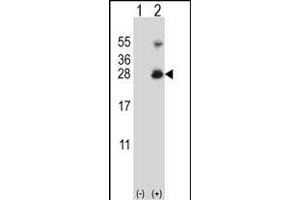 Western blot analysis of RNF11 (arrow) using rabbit polyclonal RNF11 Antibody (Center) (ABIN656832 and ABIN2846041). (RNF11 抗体  (AA 64-90))