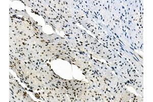 Phospho-PAK1 (Ser199) Antibody at 1/100 staining Rat stomach tissue by IHC-P.