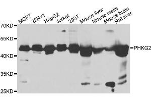 Western blot analysis of extracts of various cell lines, using PHKG2 antibody.