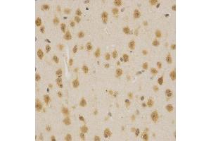 Immunohistochemistry of paraffin-embedded mouse brain using MDM2 antibody at dilution of 1:200 (x400 lens).
