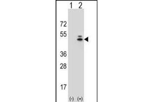 Western blot analysis of ACTG1 (arrow) using rabbit polyclonal ACTG1 Antibody (Center) (ABIN390439 and ABIN2840819). (Actin, gamma 1 抗体  (AA 188-215))