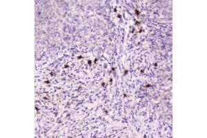 anti-Eosinophil Cationic Protein (ECP) (AA 28-160) antibody