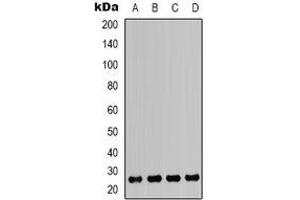Western blot analysis of HMGB1 expression in Jurkat (A), K562 (B), MCF7 (C), A549 (D) whole cell lysates. (HMGB1 抗体)