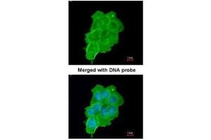 ICC/IF Image Immunofluorescence analysis of paraformaldehyde-fixed A431, using UFD1L, antibody at 1:200 dilution. (UFD1L 抗体  (full length))