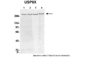 Sample Type: 1. (USP9X 抗体  (C-Term))