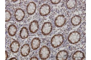 Immunoperoxidase of monoclonal antibody to FOXA1 on formalin-fixed paraffin-embedded human colon. (FOXA1 抗体  (AA 367-472))