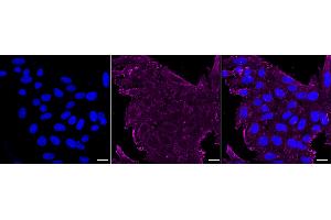 Immunocytochemical staining of HepG2 cells with Actin antibody (ABIN7797460), 1:1,000).