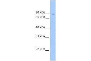 WB Suggested Anti-SATB1 Antibody Titration: 0. (SATB1 抗体  (Middle Region))