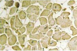 Immunohistochemistry (IHC) analyzes of Cytochrome b5 antibody in paraffin-embedded human heart tissue. (CYB5R3 抗体)