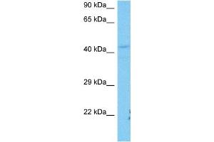 Host:  Mouse  Target Name:  SFTPB  Sample Tissue:  Mouse Liver  Antibody Dilution:  1ug/ml (SFTPB 抗体  (Middle Region))