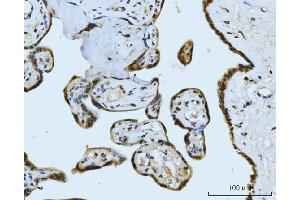 IHC analysis of MRE11 using anti-MRE11 antibody (ABIN7600025).