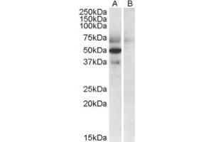 Image no. 1 for anti-Apolipoprotein L, 4 (APOL4) (C-Term) antibody (ABIN375002) (Apolipoprotein L 4 抗体  (C-Term))