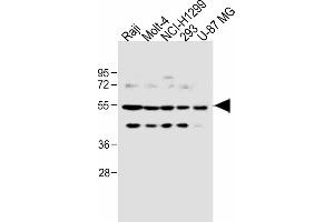 All lanes : Anti-PFKFB4 Antibody (Center) at 1:1000 dilution Lane 1: Raji, whole cell lysate Lane 2: Molt-4 whole cell lysate Lane 3: NCI- whole cell lysate Lane 4: 293 whole cell lysate Lane 5: U-87 MG whole cell lysate Lysates/proteins at 20 μg per lane. (PFKFB4 抗体  (AA 266-296))