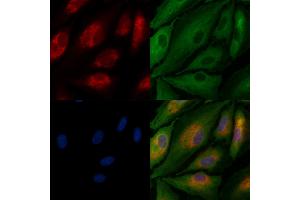 ABIN7094526 and ABIN7098575 staining  cells by IF/ICC. (GFRA3 抗体  (Internal Region))