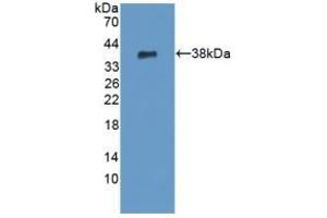 Detection of Recombinant PADI6, Human using Polyclonal Antibody to Peptidyl Arginine Deiminase Type VI (PADI6) (PADI6 抗体  (AA 393-694))