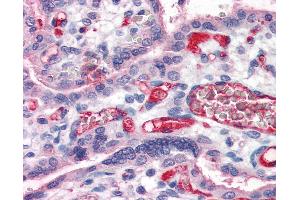 Anti-Fibrinogen antibody IHC of human placenta. (Fibrinogen 抗体  (FITC))