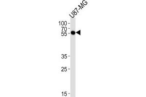 Western Blotting (WB) image for anti-Cytidine Monophosphate N-Acetylneuraminic Acid Synthetase (CMAS) antibody (ABIN3004736) (CMAS 抗体)