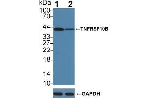 Western blot analysis of (1) Wild-type K562 cell lysate, and (2) TNFRSF10B knockout K562 cell lysate, using Rabbit Anti-Human TNFRSF10B Antibody (1 µg/ml) and HRP-conjugated Goat Anti-Mouse antibody (abx400001, 0. (TNFRSF10B 抗体  (AA 234-435))
