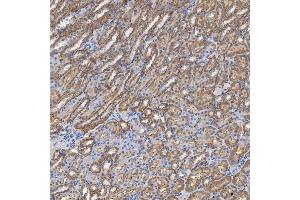 IHC analysis of SHQ1 using anti-SHQ1 antibody (ABIN7599205).