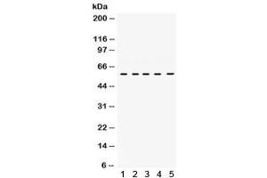 Western blot testing of human 1) HUT, 2) Jurkat, 3) Raji, 4) CEM and 5) K562 cell lysate with LCK antibody. (LCK 抗体)