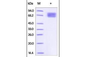SDS-PAGE (SDS) image for Interleukin 2 Receptor, alpha (IL2RA) (AA 22-213) (Active) protein (Fc Tag) (ABIN2181381)