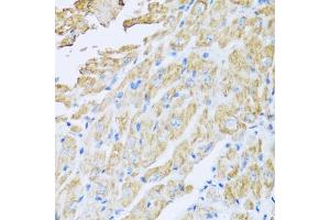 Immunohistochemistry of paraffin-embedded mouse heart using IL18BP antibody (ABIN5973845) at dilution of 1/100 (40x lens). (IL18BP 抗体)