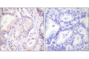 Immunohistochemistry (IHC) image for anti-Cell Division Cycle 6 Homolog (S. Cerevisiae) (CDC6) (AA 20-69), (pSer54) antibody (ABIN1531262)
