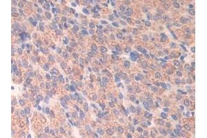 Detection of ATF7 in Mouse Ovary Tissue using Polyclonal Antibody to Activating Transcription Factor 7 (ATF7) (ATF7 抗体  (AA 50-270))