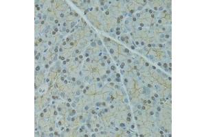 Immunohistochemistry of paraffin-embedded rat pancreas using SERPINF2 antibody  at dilution of 1:100 (40x lens). (alpha 2 Antiplasmin 抗体  (AA 302-491))