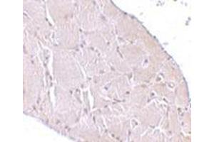 Immunohistochemistry of Wnt10a in human skeletal muscle tissue cells with this product at 10 μg/ml. (WNT10A 抗体  (C-Term))