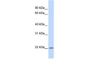 WB Suggested Anti-IFNA5 Antibody Titration: 0. (IFNA5 抗体  (Middle Region))