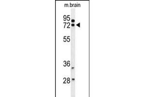 Western blot analysis of HSA Antibody (Center) (ABIN653722 and ABIN2843031) in mouse brain tissue lysates (35 μg/lane). (HSPA12A 抗体  (AA 398-427))