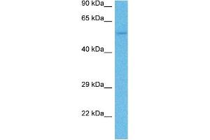 Host:  Mouse  Target Name:  TYRP1  Sample Tissue:  Mouse Liver  Antibody Dilution:  1ug/ml (Tyrosinase-Related Protein 1 抗体  (N-Term))