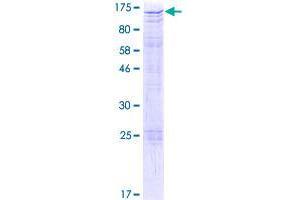 CIZ1 Protein (AA 1-818) (GST tag)