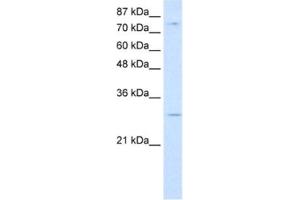 Western Blotting (WB) image for anti-RNA Binding Motif Protein 28 (RBM28) antibody (ABIN2462278) (RBM28 抗体)