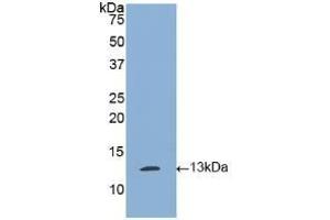 Detection of Recombinant tPA, Human using Polyclonal Antibody to Tissue Plasminogen Activator (tPA) (PLAT 抗体)