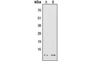 Western blot analysis of COX7A2/3 expression in HepG2 (A), Jurkat (B) whole cell lysates. (COX7A2/3 (N-Term) 抗体)