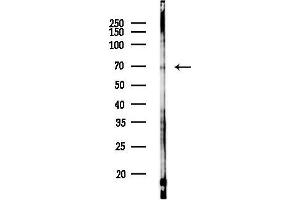 anti-Chromosome 14 Open Reading Frame 21 (C14orf21) antibody