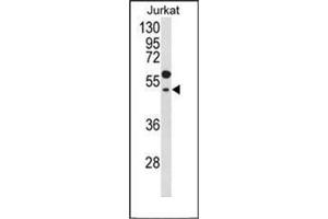 Western blot analysis of GNAT1 Antibody (C-term) in Jurkat cell line lysates (35ug/lane). (GNAT1 抗体  (C-Term))