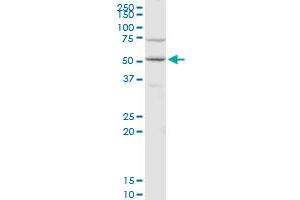 CDC14B polyclonal antibody (A01), Lot # 06046. (CDC14B 抗体  (AA 360-459))