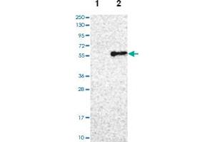 Western blot analysis of Lane 1: Negative control (vector only transfected HEK293T lysate), Lane 2: Over-expression lysate (Co-expressed with a C-terminal myc-DDK tag (~3. (AADAC 抗体)