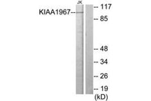 Western Blotting (WB) image for anti-Cell Cycle and Apoptosis Regulator 2 (CCAR2) (AA 431-480) antibody (ABIN2889671) (CCAR2 抗体  (AA 431-480))