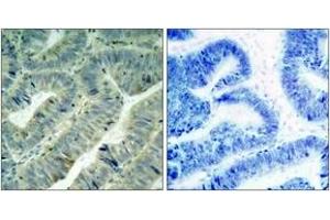 Immunohistochemistry (IHC) image for anti-Proto-oncogene tyrosine-protein kinase Src (Src) (AA 386-435), (pTyr419) antibody (ABIN1531971)