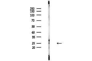 anti-Mitochondrially Encoded ATP Synthase 6 (MT-ATP6) (Internal Region) antibody