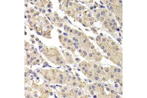 Immunohistochemistry of paraffin-embedded human stomach using DFFA antibody at dilution of 1:100 (x400 lens). (DFFA 抗体)