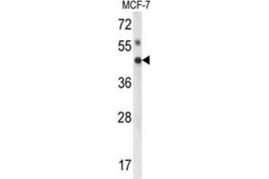 Western Blotting (WB) image for anti-Inositol Polyphosphate Multikinase (IPMK) antibody (ABIN3003997) (IPMK 抗体)